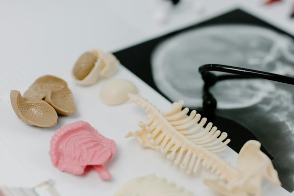 Exploration des Différences entre Perles de Verre et Sphéricité dans le Traitement de la Sclérose en Plaques : Une Nouvelle Perspective